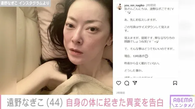 「ストレスと体の正直さ」女優・遠野なぎこが摂食障害と脱毛の体験を率直に告白